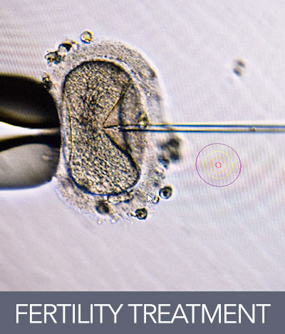 Fertility_treatment
